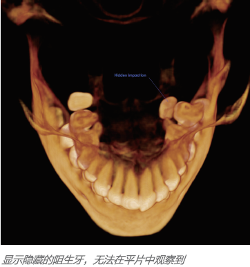 卡瓦ct