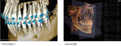 卡瓦大视野ct